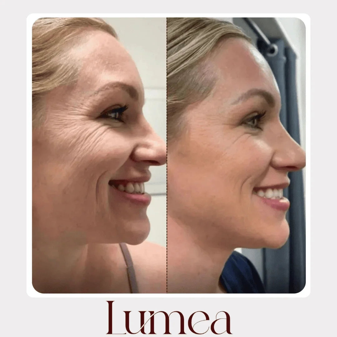 Lumea® – Rituale Viso Rinnovatore