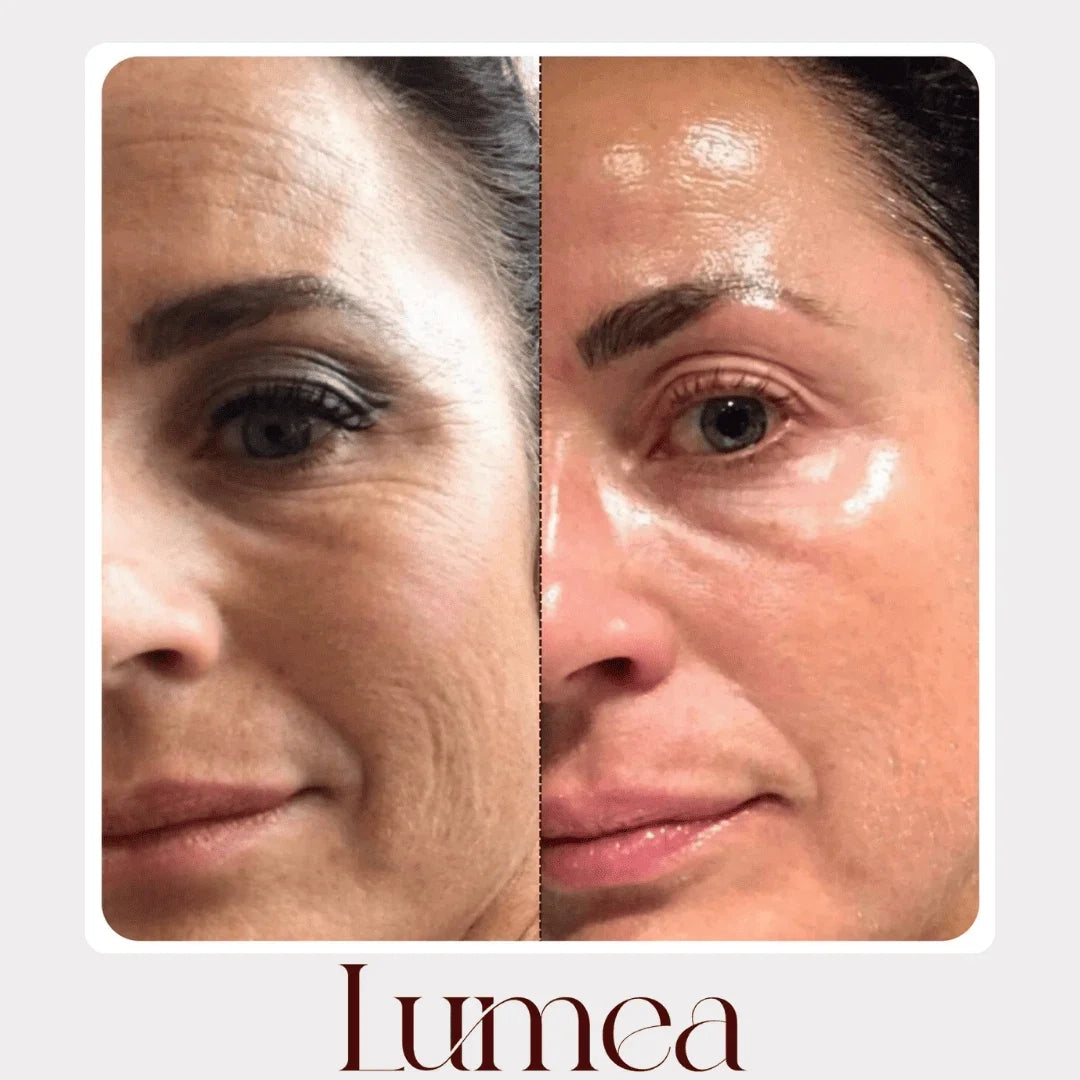 Lumea® – Rituale Viso Rinnovatore