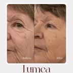 Before and after mature skin comparison showing improved-looking texture with Lumea skincare
