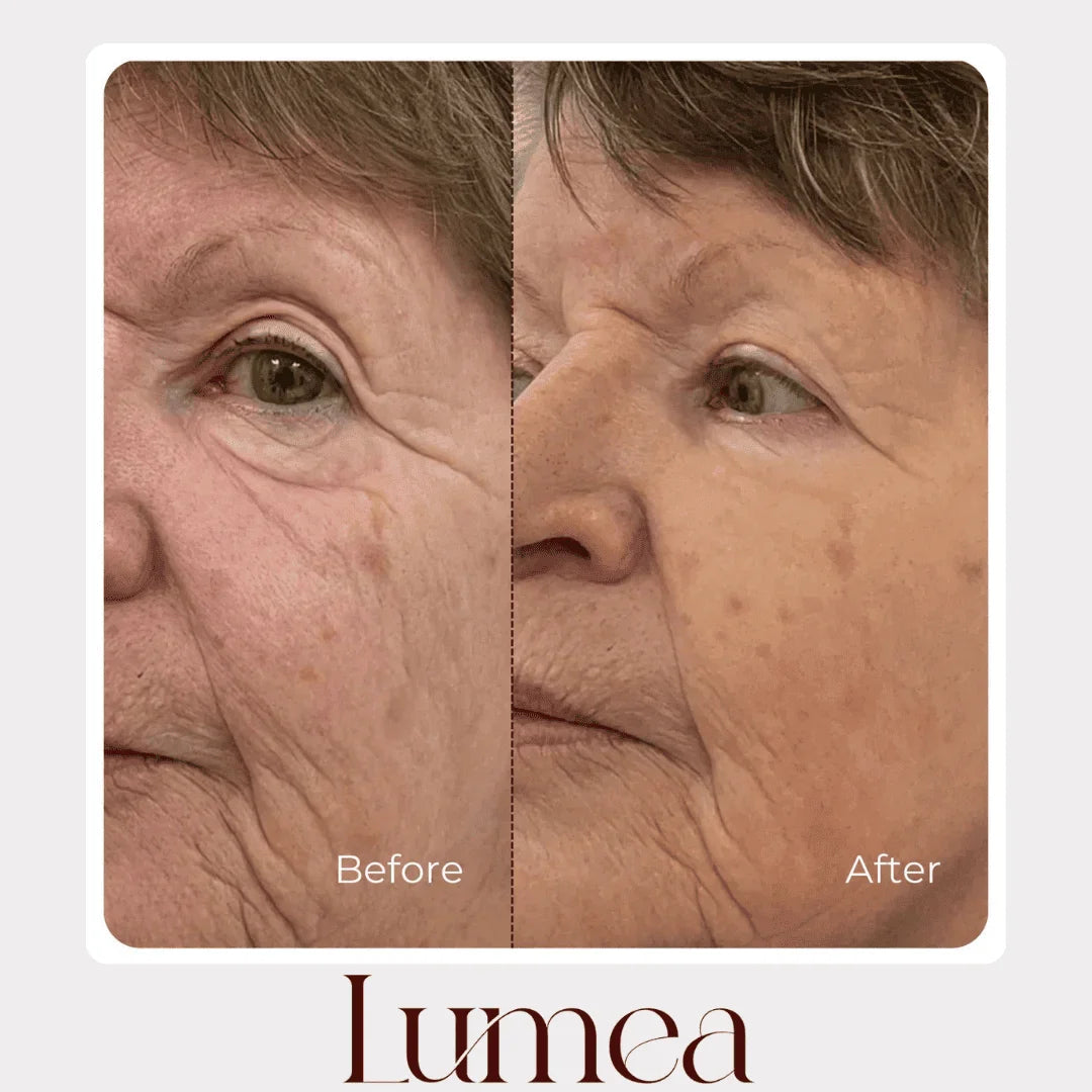 Before and after mature skin comparison showing improved-looking texture with Lumea skincare